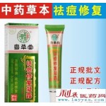 粤草堂祛痘修复凝露粉刺暗疮青春痘软膏